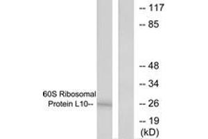 Western blot analysis of extracts from K562 cells, treated with Insulin 0. (RPL10 anticorps  (AA 1-50))