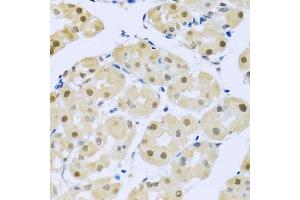 Immunohistochemistry of paraffin-embedded human stomach using SMEK1 antibody.