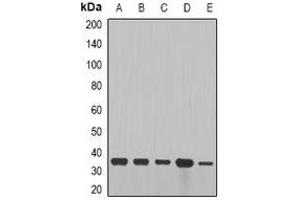 Western blot analysis of Cyclin D2 expression in SW480 (A), NIH3T3 (B), mouse brain (C), mouse lung (D), rat heart (E) whole cell lysates. (Cyclin D2 anticorps)