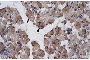 Immunohistochemical staining (Formalin-fixed paraffin-embedded sections) of human muscle with LHX9 polyclonal antibody . (LHX9 anticorps  (AA 324-373))