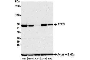 Western Blotting (WB) image for anti-Transcription Factor EB (TFEB) (C-Term) antibody (ABIN7795623) (Recombinant TFEB anticorps  (C-Term))