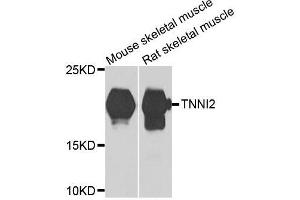 Western blot analysis of extracts of various cell lines, using TNNI2 antibody. (TNNI2 anticorps  (AA 1-100))