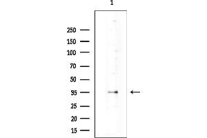 anti-Ras Homolog Gene Family, Member Q (RHOQ) (Internal Region) antibody