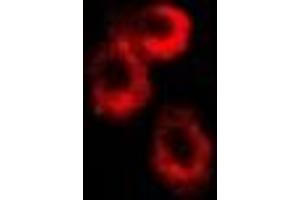 Immunofluorescent analysis of RISP staining in U2OS cells.