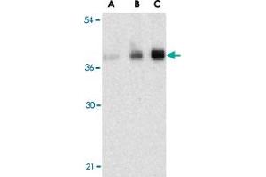 Western blot analysis of C1QTNF5 in human brain tissue lysate with C1QTNF5 polyclonal antibody  at (A) 1, (B) 2, and (C) 4 ug/mL . (CTRP5 anticorps  (N-Term))