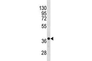 Anti-CXCR4 antibody western blot analysis in NCI-H460 lysate