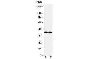 Western blot testing of APEX1 antibody and Lane 1:  rat brain;  2: mouse brain tissue lysate. (APEX1 anticorps  (Middle Region))