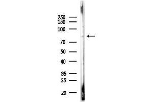 Western blot analysis of lysates from LoVo cells(heat-shock,45 min treatment), using NUP88 Antibody at 1/1000 dilution.