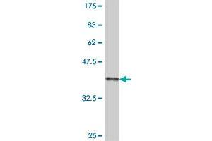 Western Blot detection against Immunogen (37.
