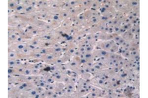 Detection of BARK in Human Liver Tissue using Polyclonal Antibody to Beta Adrenergic Receptor Kinase (BARK)