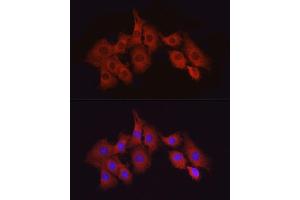 Immunofluorescence analysis of PC-12 cells using T Rabbit pAb (ABIN6130537, ABIN6143503, ABIN6143504 and ABIN6215581) at dilution of 1:50 (40x lens). (MAP3K7 anticorps  (AA 300-470))