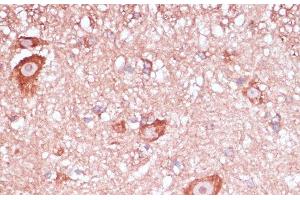 Immunohistochemistry of paraffin-embedded Mouse spinal cord using RPL32 Polyclonal Antibody at dilution of 1:100 (40x lens).