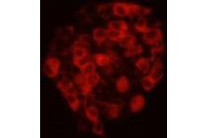 Immunocytochemistry (ICC) image for anti-Cadherin EGF LAG Seven Pass G-Type Receptor 2 (CELSR2) antibody (ABIN1112870) (CELSR2 anticorps)