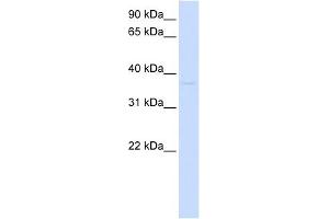 GDAP1L1 antibody used at 1 ug/ml to detect target protein. (GDAP1L1 anticorps  (N-Term))