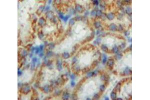 Used in DAB staining on fromalin fixed paraffin-embedded Kidney tissue (CHD3 anticorps  (AA 1551-1742))