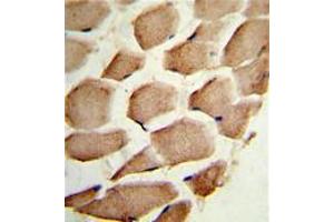 Image no. 2 for anti-Actin Related Protein 2/3 Complex, Subunit 1A, 41kDa (ARPC1A) (C-Term) antibody (ABIN452762)