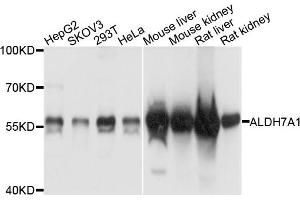 Western blot analysis of extracts of various cells, using ALDH7A1 antibody. (ALDH7A1 anticorps)