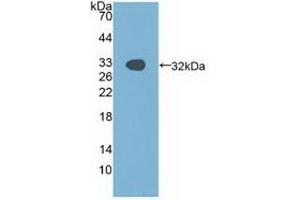 Detection of Recombinant PAK1, Human using Polyclonal Antibody to p21 Protein Activated Kinase 1 (PAK1) (PAK1 anticorps  (AA 252-501))