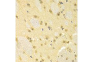 Immunohistochemistry of paraffin-embedded rat brain using SMAD1 antibody. (SMAD1 anticorps  (AA 20-240))