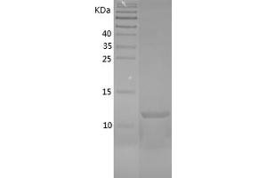 Western Blotting (WB) image for Chemokine (C-X-C Motif) Ligand 2 (CXCL2) (AA 32-100) protein (His tag) (ABIN7122339) (CXCL2 Protein (AA 32-100) (His tag))