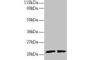 Western blot All lanes: ARL2 antibody at 2 μg/mL Lane 1: EC109 whole cell lysate Lane 2: 293T whole cell lysate Secondary Goat polyclonal to rabbit IgG at 1/15000 dilution Predicted band size: 21, 19 kDa Observed band size: 21 kDa