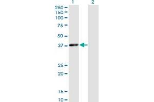 Western Blot analysis of HHEX expression in transfected 293T cell line by HHEX monoclonal antibody (M02), clone 1A5. (HHEX anticorps  (AA 1-270))