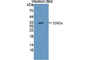 Detection of Recombinant MERTK, Human using Polyclonal Antibody to C-Mer Proto Oncogene Tyrosine Kinase (MERTK) (MERTK anticorps  (AA 587-858))