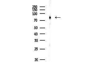Western blot analysis of lysates from HUVEC cells(heat-shock, 45 min treatment), using C Antibody at 1/1000 dilution.