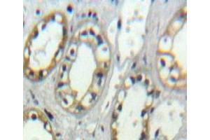 Used in DAB staining on fromalin fixed paraffin-embedded Kidney tissue (ITGAD anticorps  (AA 886-1106))