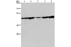 Western Blot analysis of Human fetal liver tissue, HT-29 and HUVEC cell, MCF-7 cell and Human hepatocellular carcinoma tissue using CERS4 Polyclonal Antibody at dilution of 1:300 (LASS4 anticorps)