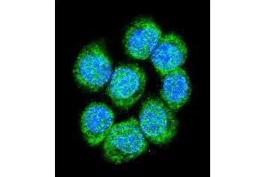 Confocal immunofluorescent analysis of CTNB1 Antibody (C-term) (ABIN655178 and ABIN2844795) with 293 cell followed by Alexa Fluor 488-conjugated goat anti-rabbit lgG (green). (CTNNB1 anticorps  (C-Term))
