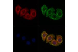 ABIN6258750 and ABIN6274361 staining Hela cells by IF/ICC. (CDK5R1 anticorps  (N-Term))