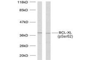 Western blot analysis of extracts from 293 cells treated with UV and MDA-MB-435 cells treated with UV, using BCL-XL (Phospho-Ser62) Antibody. (BCL2L1 anticorps  (pSer62))