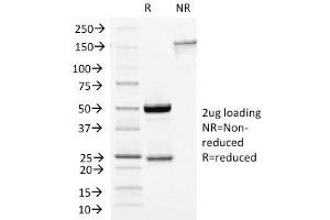 SDS-PAGE Analysis Purified Growth Hormone Mouse Monoclonal Antibody (GH/1450). (Growth Hormone 1 anticorps  (AA 58-187))
