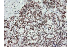 Image no. 4 for anti-Myeloid Leukemia Factor 1 (MLF1) antibody (ABIN1499493)