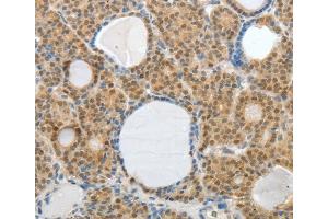 Immunohistochemistry (IHC) image for anti-A Kinase (PRKA) Anchor Protein 6 (Akap6) antibody (ABIN2426541)