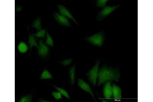 Immunofluorescence of monoclonal antibody to UBE2G1 on HeLa cell. (UBE2G1 anticorps  (AA 1-170))