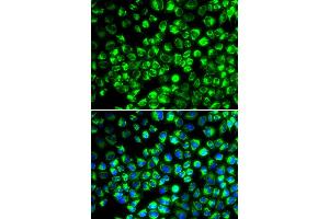 Immunofluorescence analysis of HeLa cell using ATP6AP2 antibody. (ATP6AP2 anticorps)
