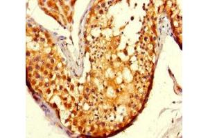 Immunohistochemistry of paraffin-embedded human testis tissue using ABIN7177995 at dilution of 1:100 (ADCK2 anticorps  (AA 200-609))