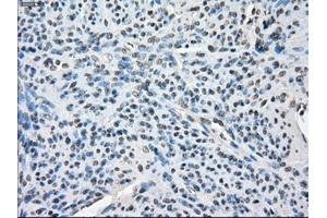 Immunohistochemical staining of paraffin-embedded colon tissue using anti-BUB1Bmouse monoclonal antibody. (BUB1B anticorps)