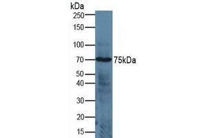 Detection of ADAM17 in Human Jurkat Cells using Polyclonal Antibody to A Disintegrin And Metalloprotease 17 (ADAM17) (ADAM17 anticorps  (AA 226-473))