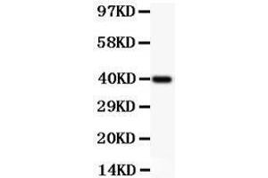 Anti-NFkB p100 Picoband antibody,  All lanes: Anti NFKBP100  at 0.