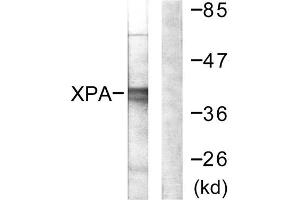 Western blot analysis of extracts from COLO205 cells, using XPA antibody. (XPA anticorps  (C-Term))
