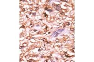 Image no. 2 for anti-Tumor Protein P53 (TP53) (pThr18) antibody (ABIN358195) (p53 anticorps  (pThr18))