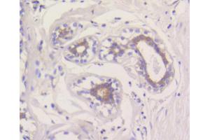 Immunohistochemistry of paraffin-embedded human breast using MCL1 antibody (ABIN5997051) at dilution of 1/100 (40x lens). (MCL-1 anticorps)
