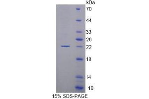 SDS-PAGE (SDS) image for Molybdenum Cofactor Synthesis 1 (MOCS1) (AA 1-160) protein (His tag) (ABIN4989413)