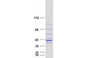 Validation with Western Blot