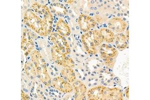 Immunohistochemistry of paraffin embedded rat kidney using RBP (ABIN7075409) at dilution of 1: 700 (400x lens)