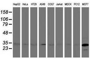 Image no. 3 for anti-Bridging Integrator 3 (BIN3) antibody (ABIN1496922)