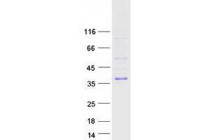 Validation with Western Blot